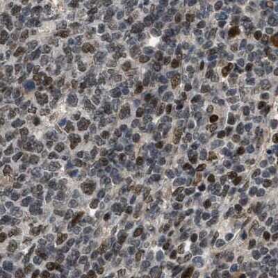 Immunohistochemistry-Paraffin: SERTAD2 Antibody [NBP1-81541]