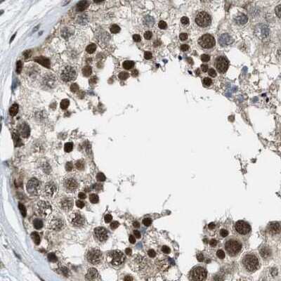 Immunohistochemistry-Paraffin: SERTAD2 Antibody [NBP1-81541]