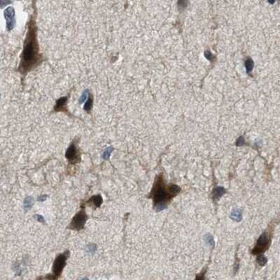 Immunohistochemistry-Paraffin: SERTAD2 Antibody [NBP1-81541]