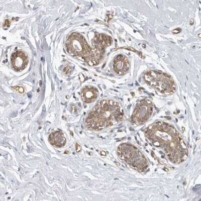 Immunohistochemistry-Paraffin: SERTAD4 Antibody [NBP1-84216]