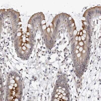 Immunohistochemistry-Paraffin: SERTAD4 Antibody [NBP1-84216]