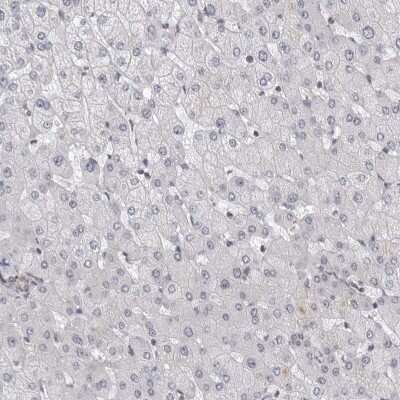 Immunohistochemistry-Paraffin: SERTAD4 Antibody [NBP1-84216]