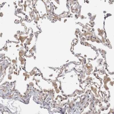 Immunohistochemistry-Paraffin: SERTAD4 Antibody [NBP1-84216]