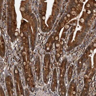 Immunohistochemistry-Paraffin: SERTAD4 Antibody [NBP1-84217]