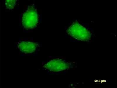 Immunocytochemistry/ Immunofluorescence: SESN1 Antibody [H00027244-B01P]