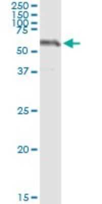 Immunoprecipitation: SESN2 Antibody (3B8) [H00083667-M03]