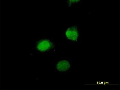 Immunocytochemistry/ Immunofluorescence: SESN3 Antibody [H00143686-B01P]
