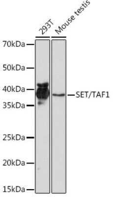 Western Blot: SET Antibody (8E8M9) [NBP3-16775]