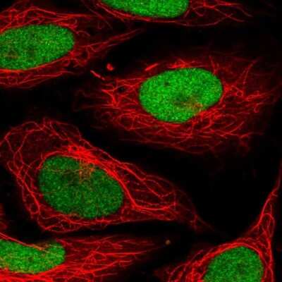 Immunocytochemistry/ Immunofluorescence: SET Antibody [NBP2-38031]