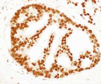 Immunohistochemistry-Paraffin: SET Antibody [NBP1-26647]