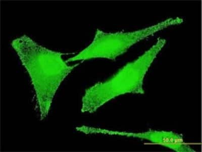 Immunocytochemistry/ Immunofluorescence: SET Antibody (M1-F5) [H00006418-M01]