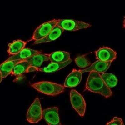 Immunocytochemistry/ Immunofluorescence: SET Antibody (PCRP-SET-1C6) [NBP3-07837]