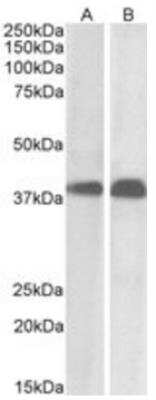 Western Blot: SET Antibody [NB100-817]