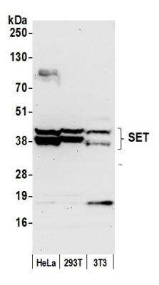 Western Blot: SET Antibody [NBP1-26646]