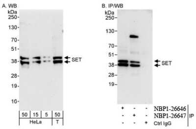 Western Blot: SET Antibody [NBP1-26647]