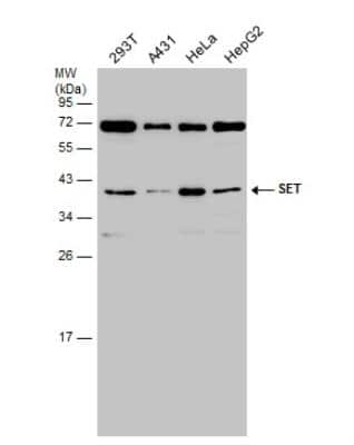 Western Blot: SET Antibody [NBP1-30888]