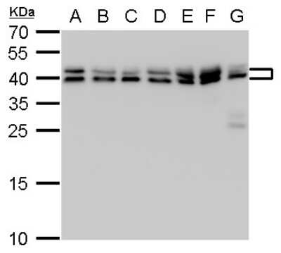 Western Blot: SET Antibody [NBP1-33713]