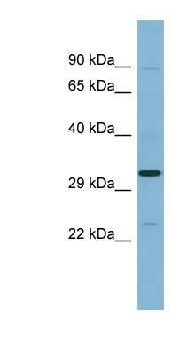 Western Blot: SET Antibody [NBP1-58201]