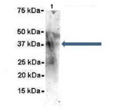 Western Blot: SET Antibody [NBP1-58201]