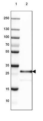 Western Blot: SET Antibody [NBP2-38031]