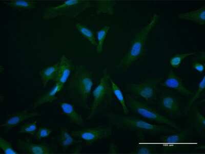 Immunocytochemistry/ Immunofluorescence: SETBP1 Antibody [H00026040-B01P]