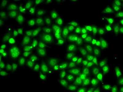 Immunocytochemistry/ Immunofluorescence: SETBP1 Antibody - BSA Free [NBP2-93021]