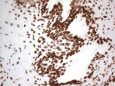 Immunohistochemistry: SETD1A Antibody (OTI7B7) [NBP2-45790]