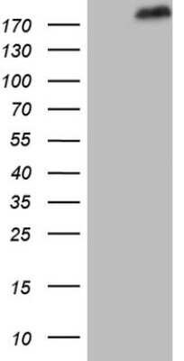 Western Blot: SETD1A Antibody (OTI7B7) [NBP2-45790]