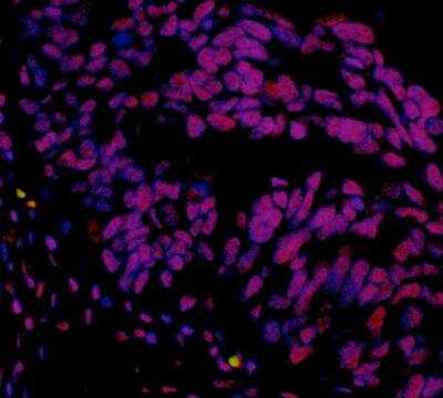 Immunofluorescence: SETD1A Antibody (BLR024E) [NBP2-76401]