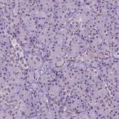 Immunohistochemistry-Paraffin: SETD1A Antibody [NBP2-49281]