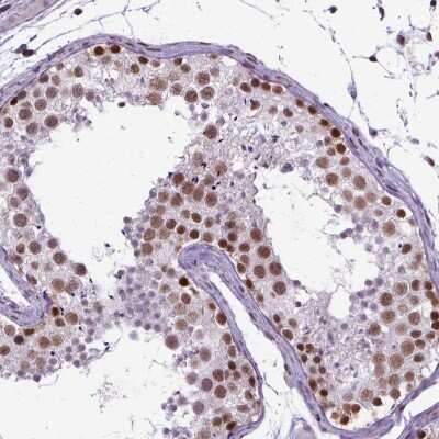 Immunohistochemistry-Paraffin: SETD1A Antibody [NBP2-49281]
