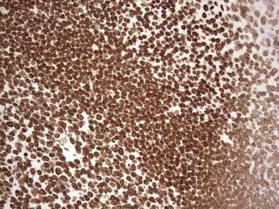 Immunohistochemistry: SETD1A Antibody (OTI7B7) - Azide and BSA Free [NBP2-74144]