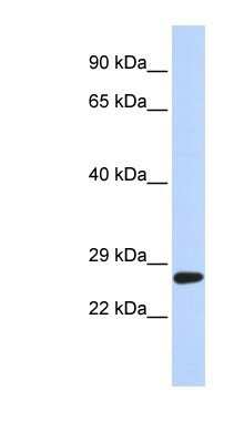 Western Blot: SETD4 Antibody [NBP1-80045]