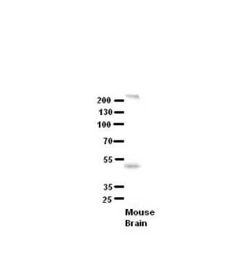Western Blot: SETD4 Antibody [NBP1-80045]