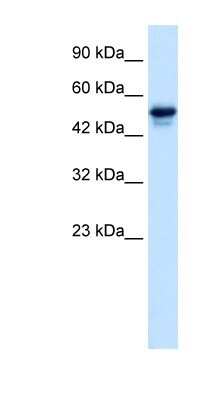 Western Blot: SETD4 Antibody [NBP1-80046]