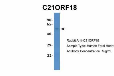 Western Blot: SETD4 Antibody [NBP1-80046]