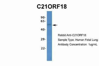 Western Blot: SETD4 Antibody [NBP1-80046]