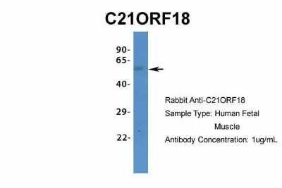 Western Blot: SETD4 Antibody [NBP1-80046]
