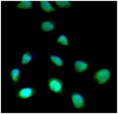 Immunocytochemistry/ Immunofluorescence: SETD7/9 Antibody (s4E5) - BSA Free [NBP1-04298]