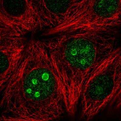 Immunocytochemistry/ Immunofluorescence: SETD7 Antibody [NBP2-34101]