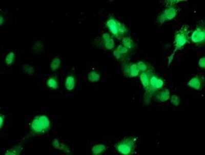 Immunocytochemistry/ Immunofluorescence: SETD7 Antibody (OTI2D10) - Azide and BSA Free [NBP2-74145]