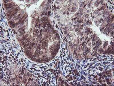 Immunohistochemistry: SETD7 Antibody (OTI2D10) - Azide and BSA Free [NBP2-74145]