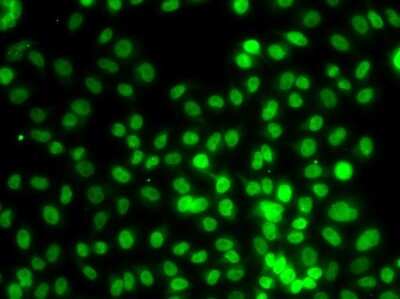 Immunocytochemistry/ Immunofluorescence: SETD8 Antibody - BSA Free [NBP2-93042]