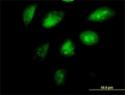 Immunocytochemistry/ Immunofluorescence: SETDB1 Antibody (4A3) [H00009869-M07]