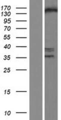 Western Blot: SETDB1 Overexpression Lysate [NBP2-09749]