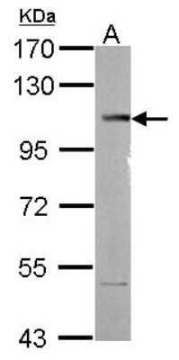 Western Blot: SETDB2 Antibody [NBP2-20323]