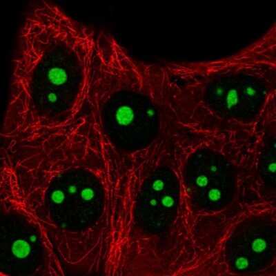 Immunocytochemistry/ Immunofluorescence: SETMAR Antibody [NBP2-58313]