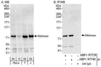 Immunoprecipitation: SETMAR Antibody [NBP1-97739]