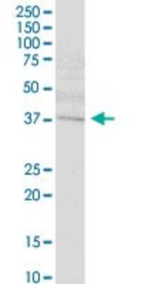 Western Blot: SETMAR Antibody [H00006419-B01P]
