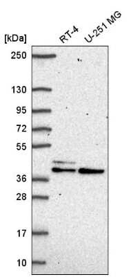 Western Blot: SETMAR Antibody [NBP2-58313]